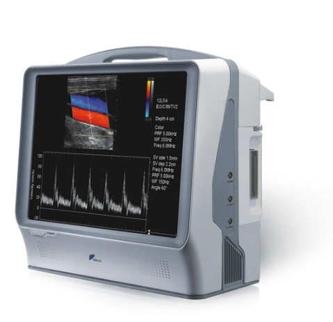 血管内超声诊断仪AngioPlus IVUS