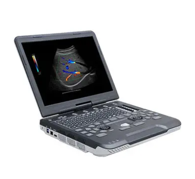 Apogee 1100全数字彩色多普勒超声诊断系统