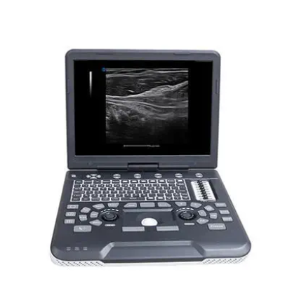 Apogee 1000全数字彩色多普勒超声诊断系统