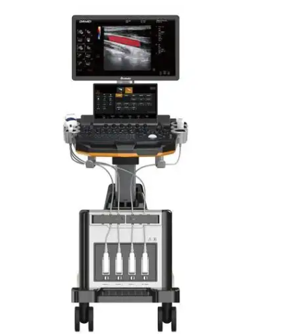 Digi-Lite IP彩色多普勒超声诊断仪