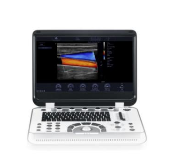 Finus 60便携式彩色多普勒超声诊断系统