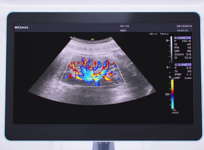 Acclarix LX9 Super推车式全数字彩色超声诊断系统