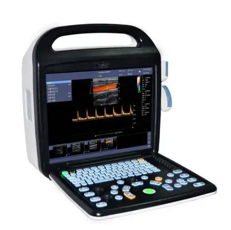 TINGSN FINDERS 1便携式彩色超声诊断仪