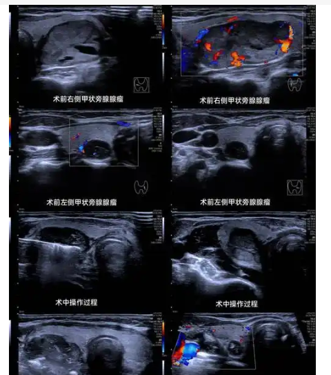 SW-UL01/II甲状腺超声影像定位分析软件