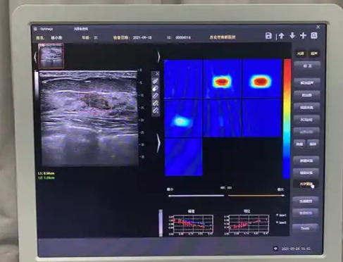 AIBUS100乳腺超声诊断系统