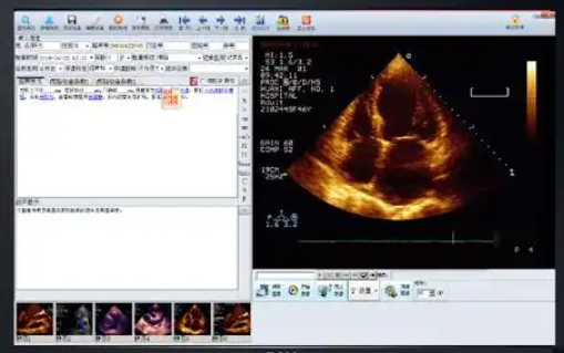 astraia V1超声工作站软件