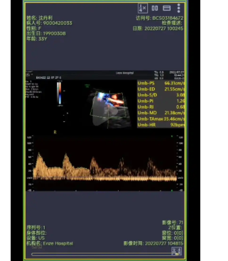 Soundwise_Ultrasound_ST超声影像存储与传输云平台软件