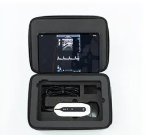 SonoEye P1-G全数字掌上彩色多普勒超声诊断仪