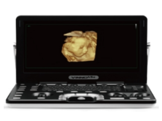 VINNO Q3E＋7L掌上彩色超声诊断仪