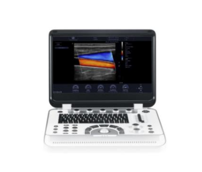Finus 80便携式彩色多普勒超声诊断系统