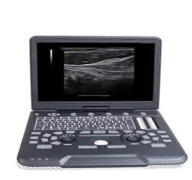 Apogee 6800全数字彩色多普勒超声诊断系统