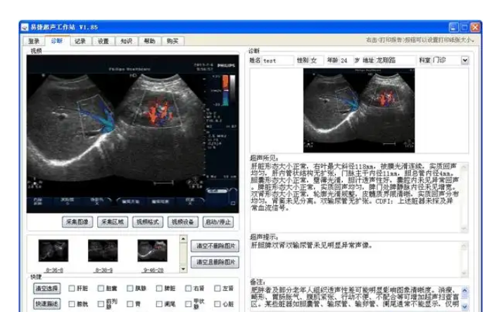 XB-CS-VW语音超声工作站系统软件