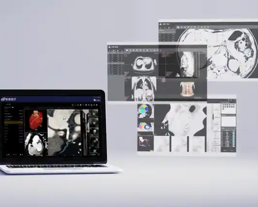 AD-UL-I超声影像处理软件