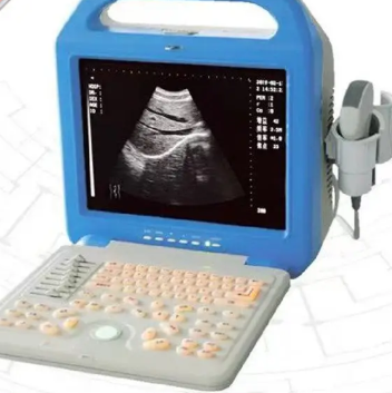 KR-1088V全数字超声诊断仪