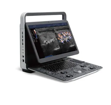 S70 Exp彩色多普勒超声诊断系统