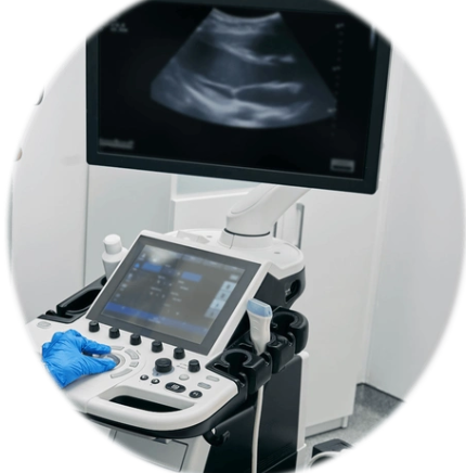 TrueView AUBISVIEWER乳腺超声影像分析软件