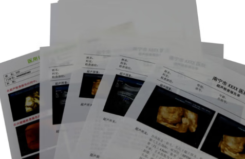 ZDGK/CQ-A干式超声诊断报告胶片直销