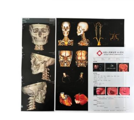 DC-CS-810干式超声诊断报告胶片
