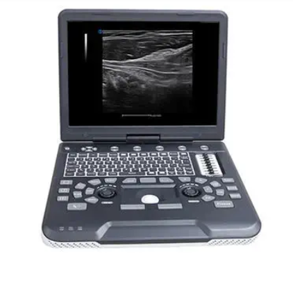 全数字彩色多普勒超声诊断系统Apogee 1200平台