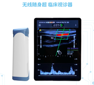 双探头无线掌上彩色多普勒超声显像仪D2CL代理