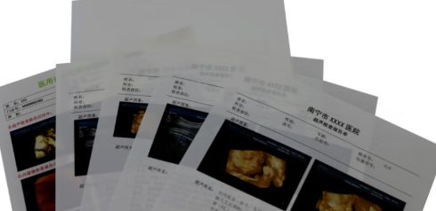 干式超声诊断报告胶片博施洛