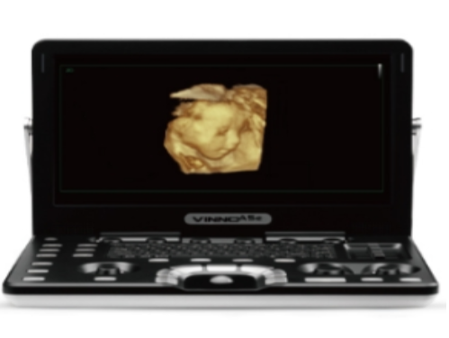 飞依诺掌上彩色超声诊断仪VINNO Q3S-3C厂家