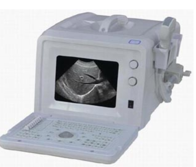 乐普便携式B型超声诊断仪LeView-100代理