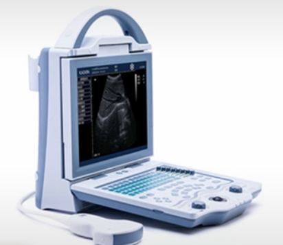 凯信全数字B型超声诊断仪KX5600代理