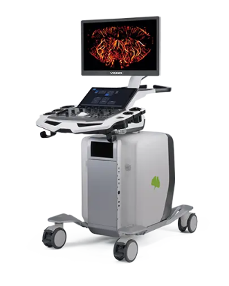 飞依诺数字化彩色超声诊断仪VINNO R330代理