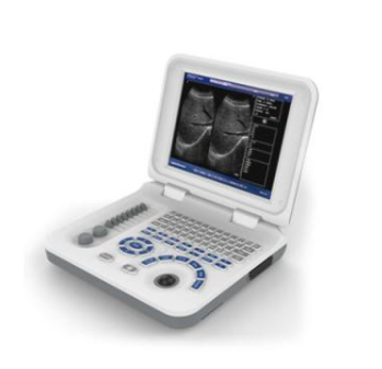 B型超声诊断仪XF300厂家直销