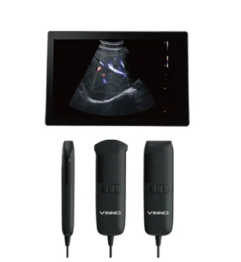 飞依诺掌上彩色超声诊断仪VINNO Q5S-2P询价