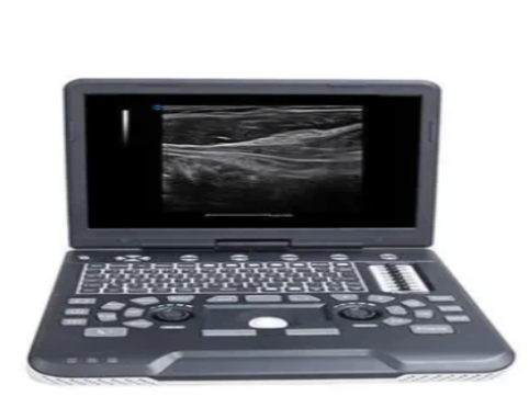 全数字彩色多普勒超声诊断系统Apogee 4500询价