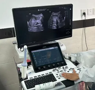 通用超声诊断仪LOGIQ E20询价