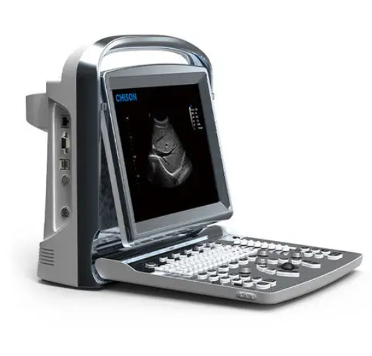 全数字彩色超声诊断系统ECO 5供应商