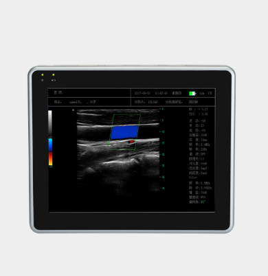 威尔德平板式全数字彩色多普勒超声诊断系统wEye8代理