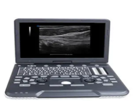 全数字彩色多普勒超声诊断系统Apogee 2000询价
