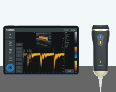 汇声微型彩色超声诊断系统C30C代理
