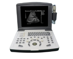 刊智便携式全数字彩色超声诊断仪KZ-02代理