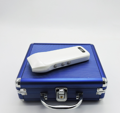 速诺视手持式超声诊断仪SP-V3-7.5L401厂家