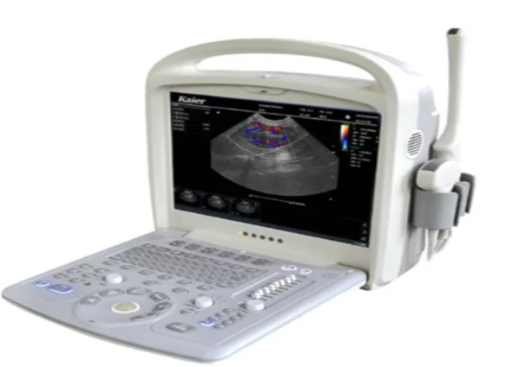 居天无线掌上彩色多普勒超声显像仪MT12P询价