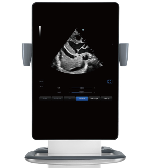 迈瑞便携式彩色多普勒超声系统TE9代理