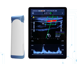 驼人无线掌上彩色超声诊断仪TR-WP1厂家