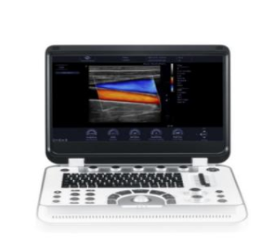 聚融便携式彩色多普勒超声诊断系统Finus 80Pro代理