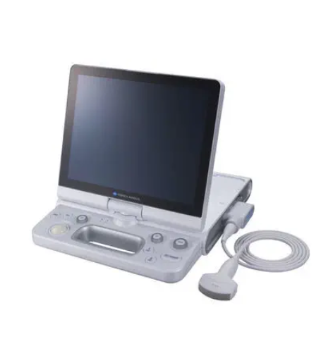 美能达超声诊断系统SONIMAGE HS2代理