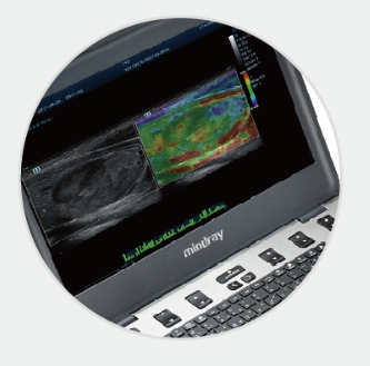 迈瑞便携式彩色多普勒超声系统M9 Super供应商