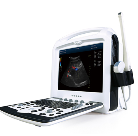 永锦便携式彩色多普勒超声诊断系统A5Exp询价