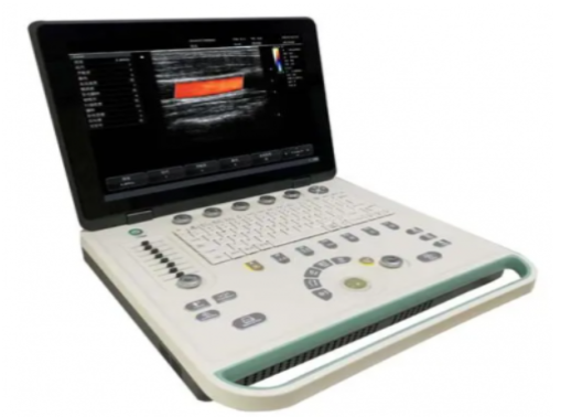 掌上彩色多普勒超声诊断仪300C供应商