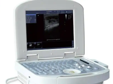 全数字彩色多普勒超声诊断系统A30T供应商
