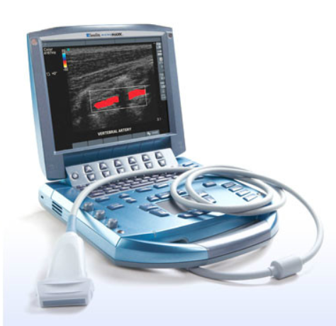立声全数字手持式超声诊断仪Q1供应商