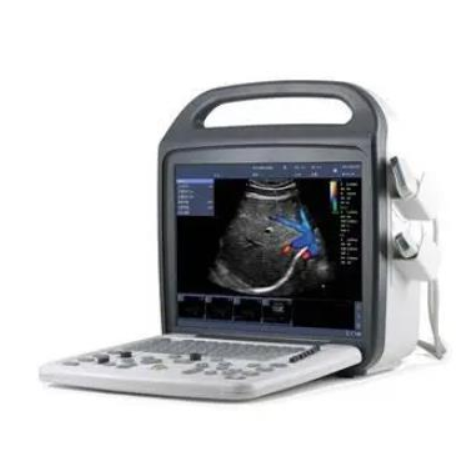 贝朗便携式彩色多普勒超声诊断系统供应商